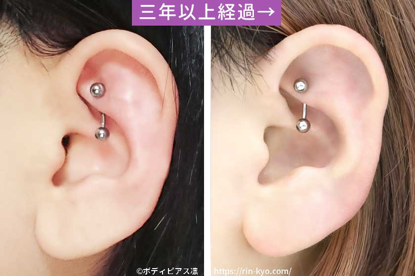 開けて3年経過したロック