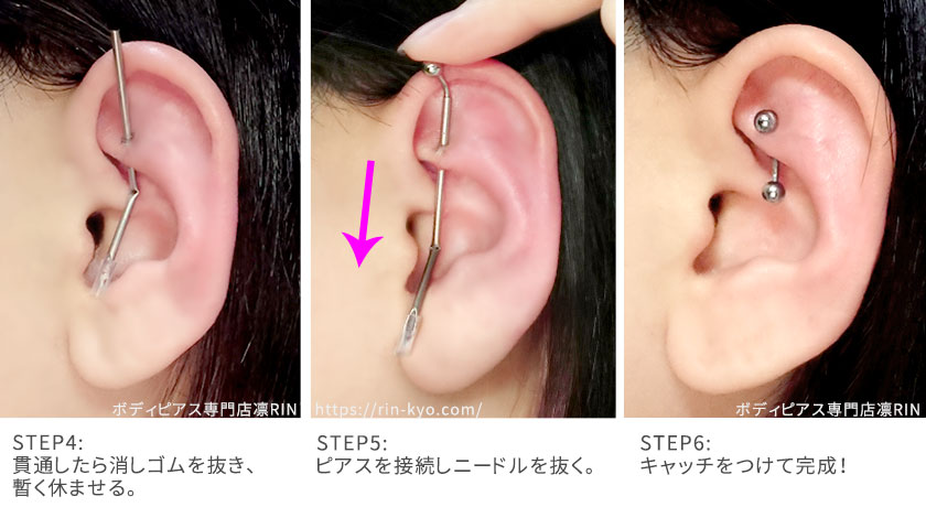 軟骨ピアス・ロック（ルーク）の開け方・痛みや排除について